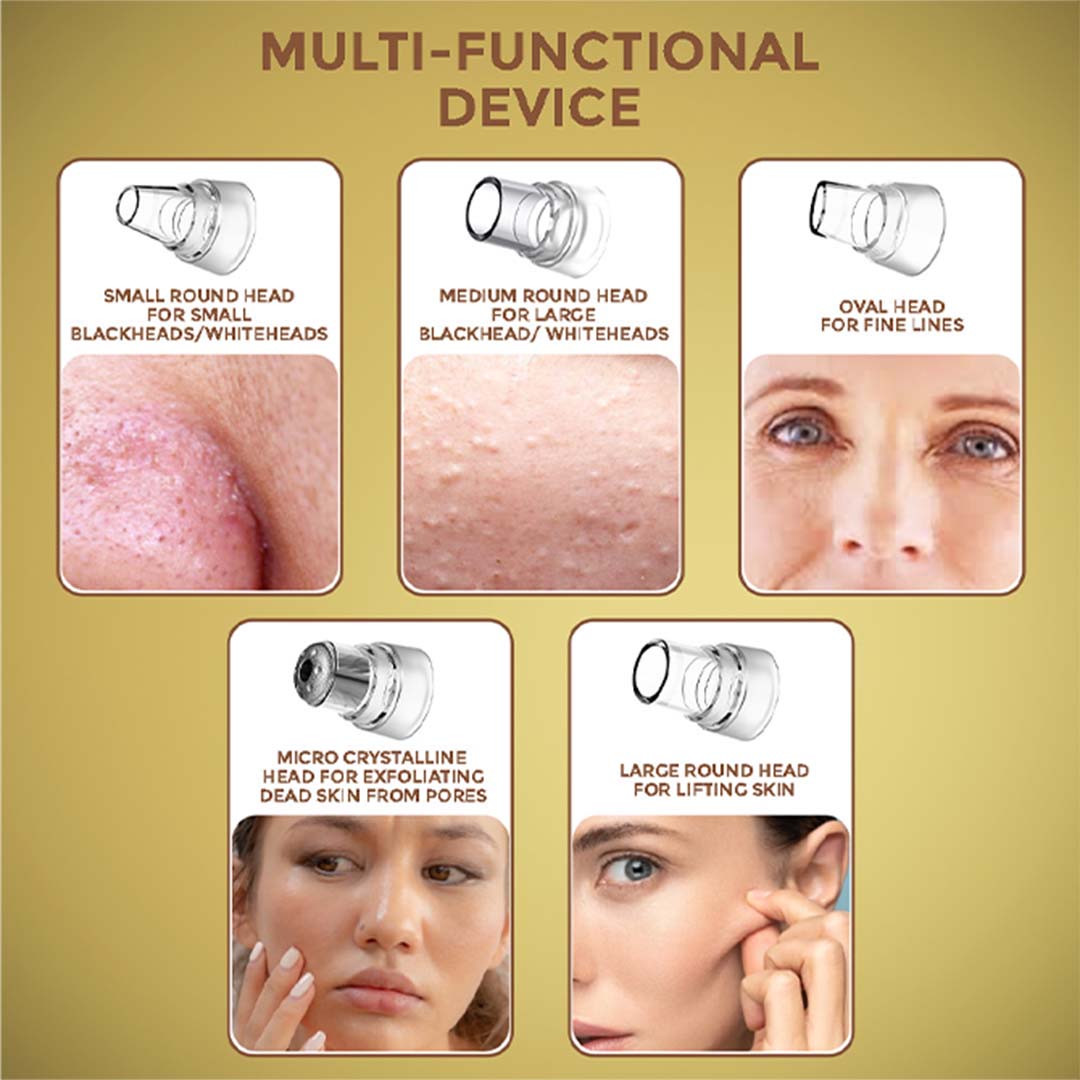 Winston Vacuum Acne Pore Cleanser/ Blackhead Remover with 3 Suction Modes & 5 Replaceable Heads