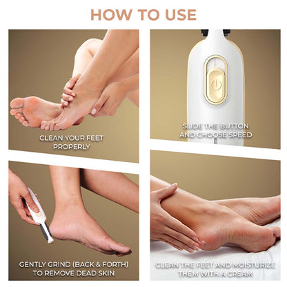 Winston Callus Remover for Healing Cracked Feet & Dead Skin Removal